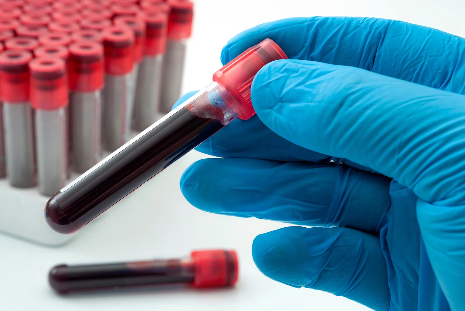 Close-up of a gloved hand holding a blood-filled test tube with a red cap, with additional blood sample tubes in the background.